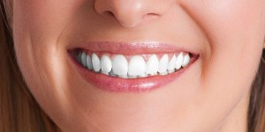 Dental Implant result 