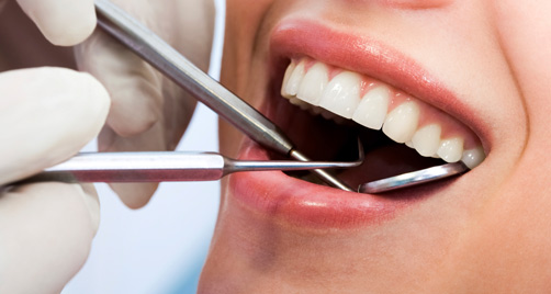 dental check up