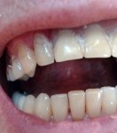 man's teeth 