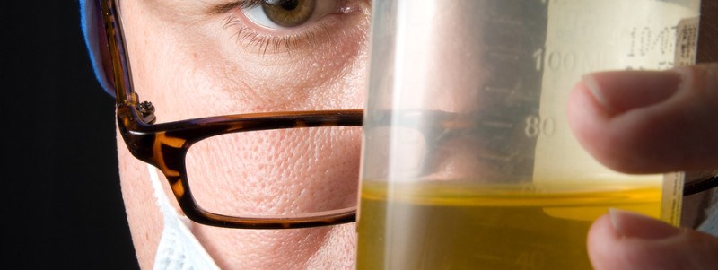 testing urine