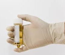 urine sample 