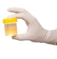 urine in container
