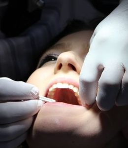 woman opening mouth 