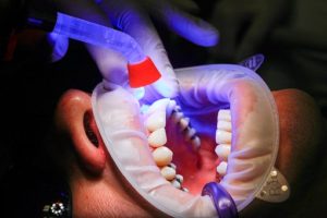 dental check up